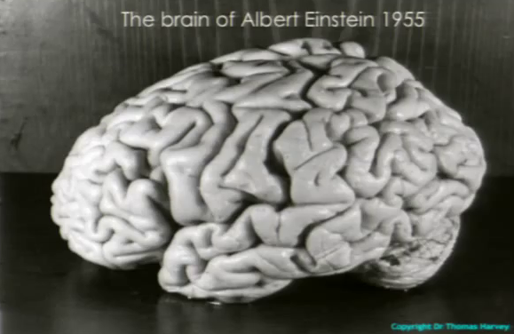 Einstein's brain